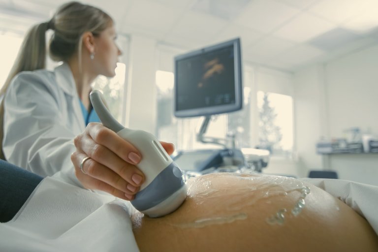A Sonographer carrying out fetal ultrasound on a women's belly