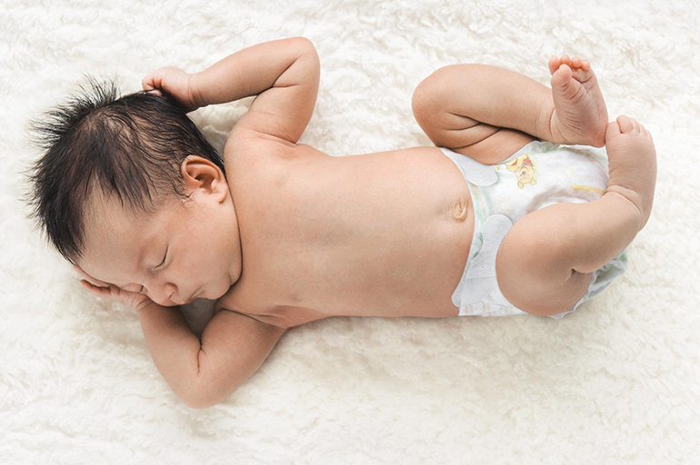 A diapered baby lying on a white towel
