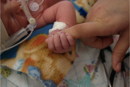A NICU baby gripping an index finger of a hand