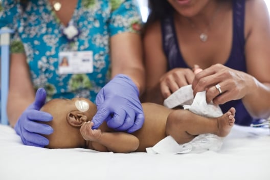 A diapered baby being cleaned by Healthcare professionals